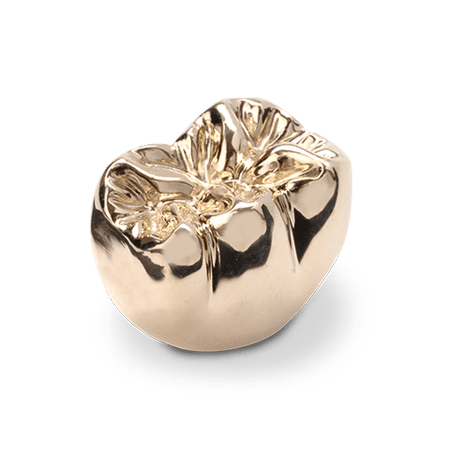 Full Gold Crown, Inlays and Onlays